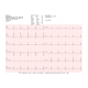 Electrocardiographe ECG Cardioline Touchecg HD+ Bluetooth (12 pistes) pour PC ou tablette Windows