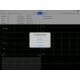 Electrocardiographe ECG Edan PADECG Numérique sans fil pour iPad avec interprétation