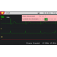 Electrocardiographe ECG Schiller AT1 G2 Cardiovit (3 pistes) avec interprétation