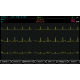 Electrocardiographe ECG Spengler Cardiomate 3 (3 pistes) avec interprétation