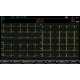 Electrocardiographe ECG Spengler Cardiomate 6 (6 pistes) avec interprétation