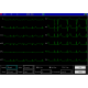 Electrocardiographe ECG Contec 1200G (12 pistes) avec interprétation