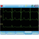 Electrocardiographe ECG Contec 90A (3 pistes) avec interprétation