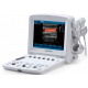 Echographe portable à ultrasons Edan U50