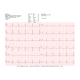 Electrocardiographe ECG Cardioline Touchecg HD+ Bluetooth (12 pistes) pour Windows avec tablette 10"