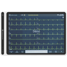Electrocardiographe ECG Spengler Cardiomate EVI 7" (12 pistes) avec interprétation