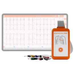 ECG 12 pistes 1200G CONTEC interprétation et mémoire